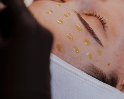 huidbehandelingen afbeelding BioRePeel