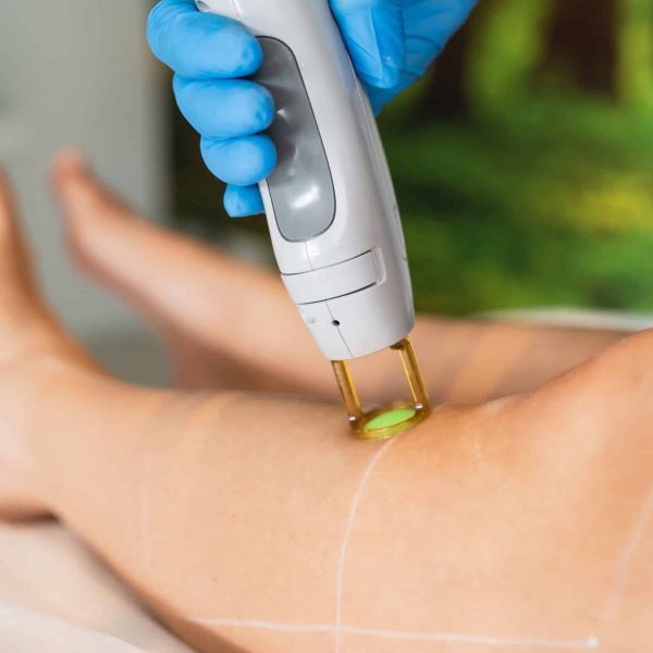 Laser ontharen onderbenen - Stralend - De GentleMax PRO