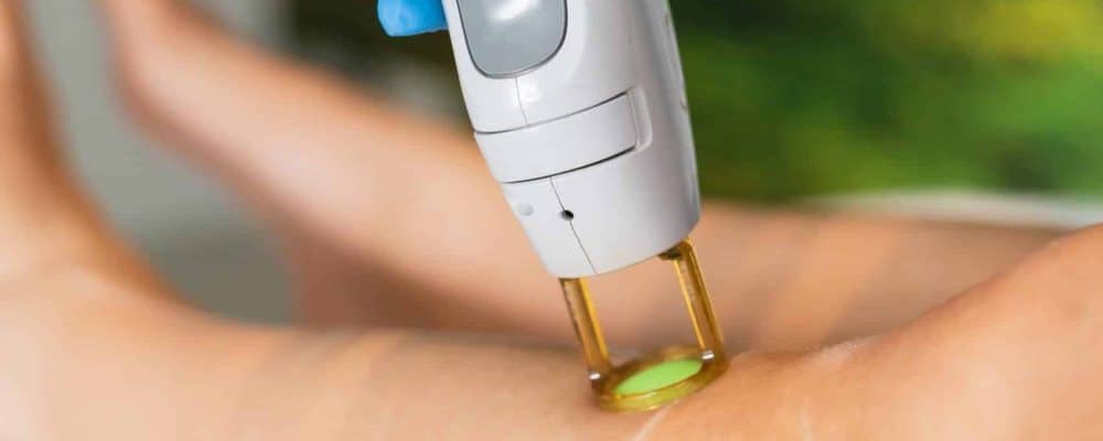 Laser ontharen onderbenen - Stralend - De GentleMax PRO