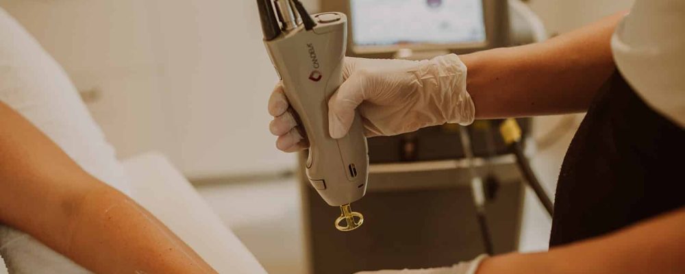 Header laserontharing